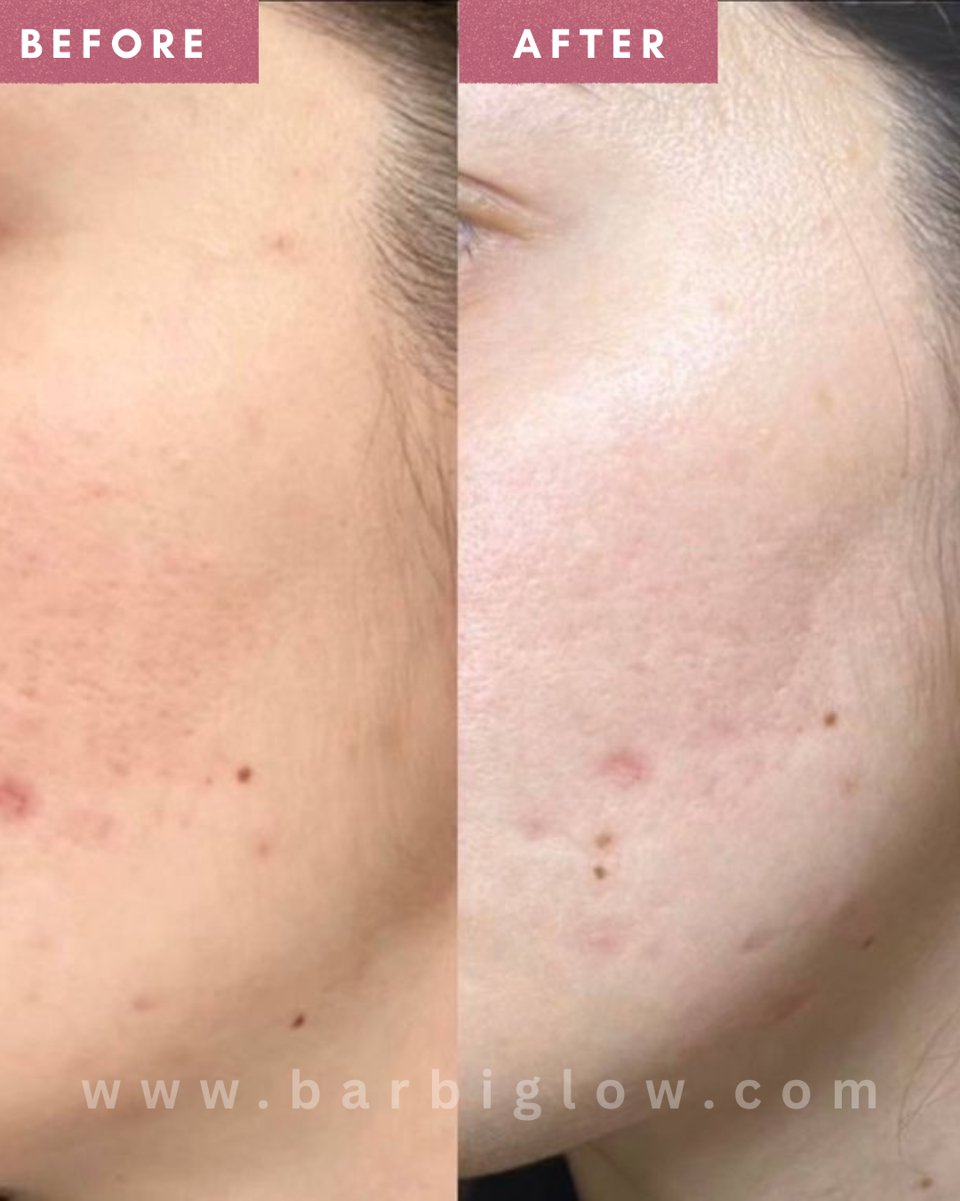 Korean Glass Skin Whitening Cream
